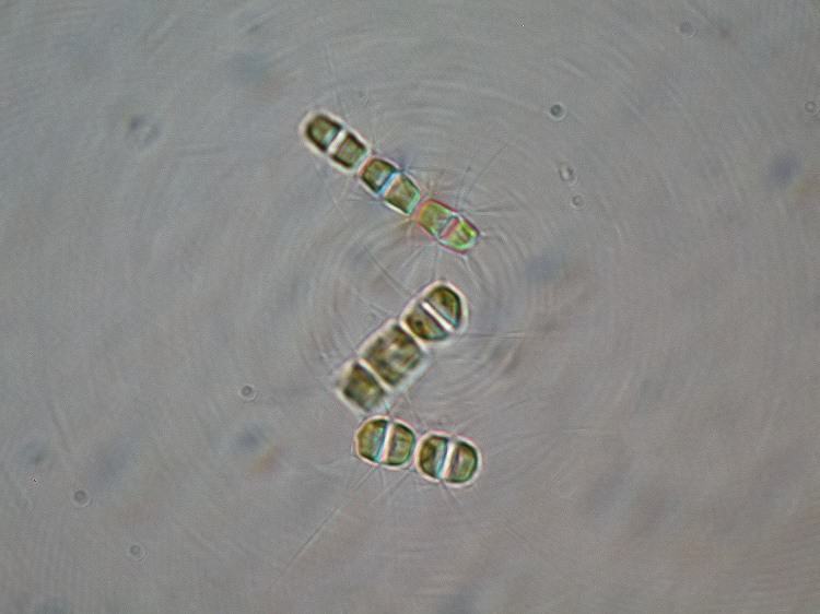 スーパー珪藻光学顕微鏡写真