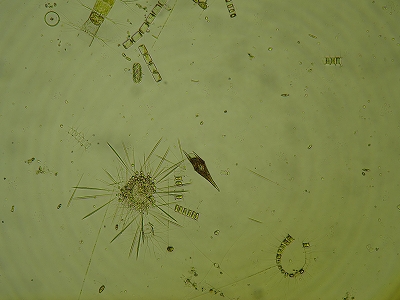 採集したプランクトンの顕微鏡写真