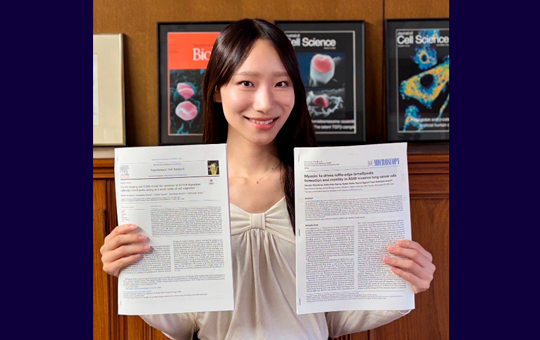 医学部生が筆頭著者として2本目の英文論文を発表!~がん細胞の新たな移動様式「ラッフル縁ラメリポディア」の形成メカニズムを解明~