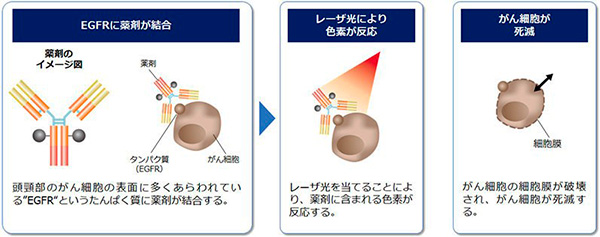 光免疫療法web.jpg