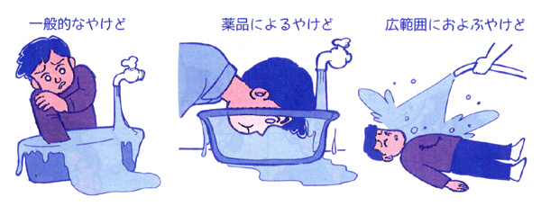 化学熱傷とは何ですか?